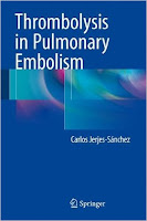 http://www.cheapebookshop.com/2016/01/thrombolysis-in-pulmonary-embolism.html
