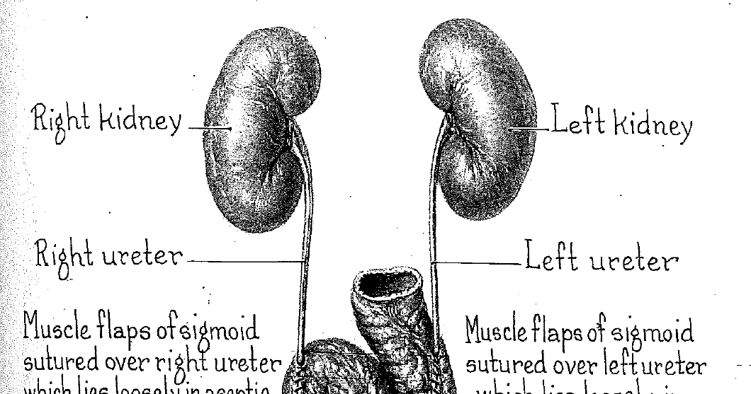 Brady Urology at Johns Hopkins Hospital Historical Contribution 1942