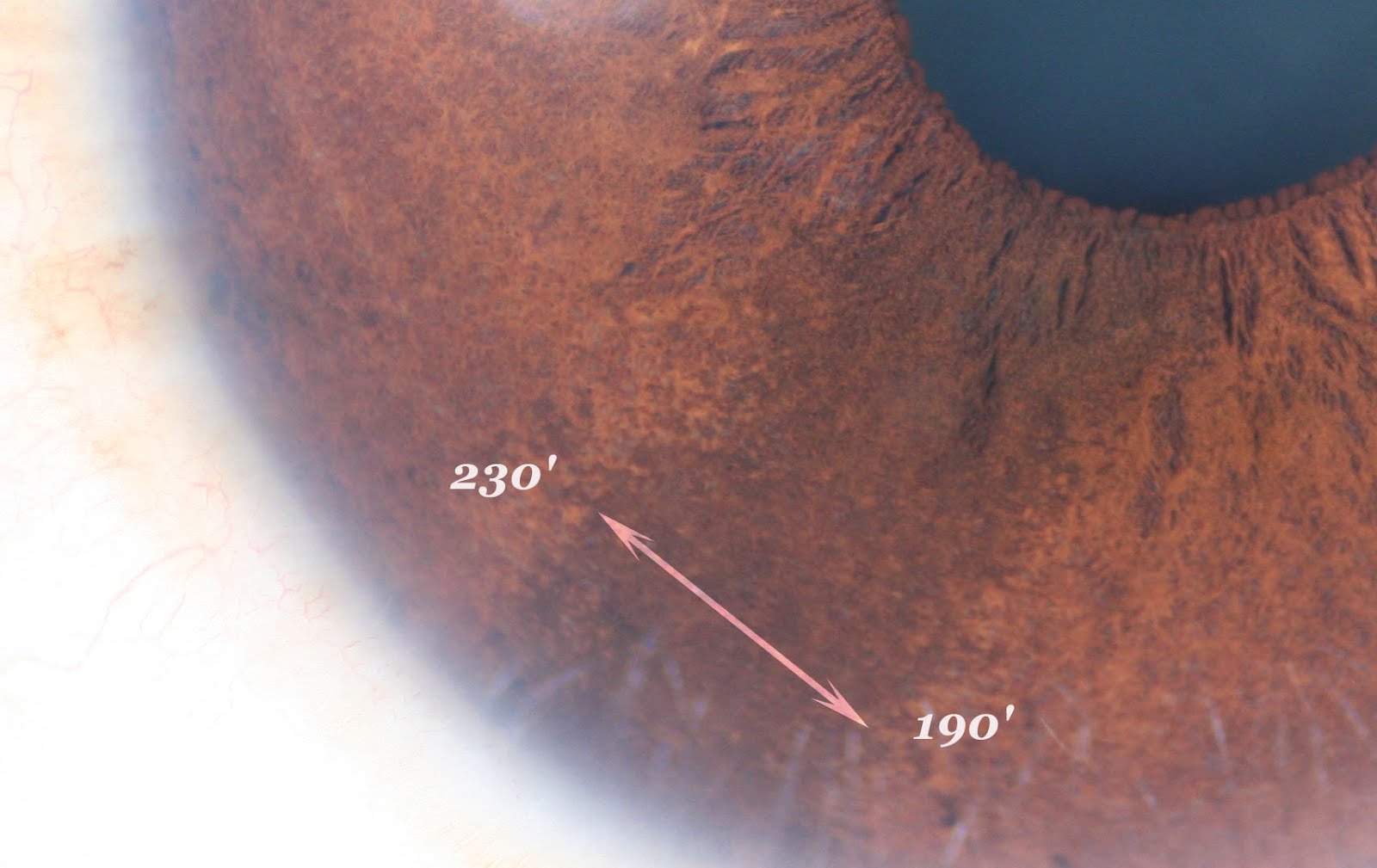 Cat Iridology Chart