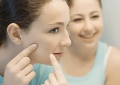 Cara Paling Tepat Merawat Wajah Berminyak dan Berjerawat http://tubuhindahcantik.blogspot.com/