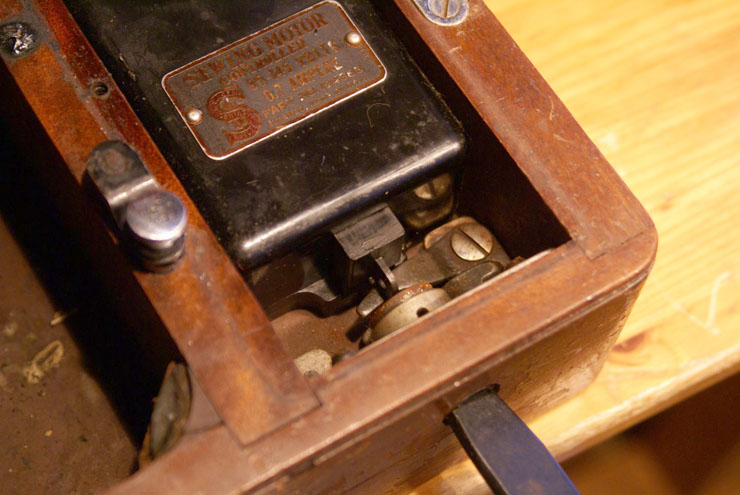 The Vintage Singer Sewing Machine Blog: Reader Questions: Eric's Knee