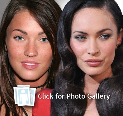 Megan Fox plastic surgery
