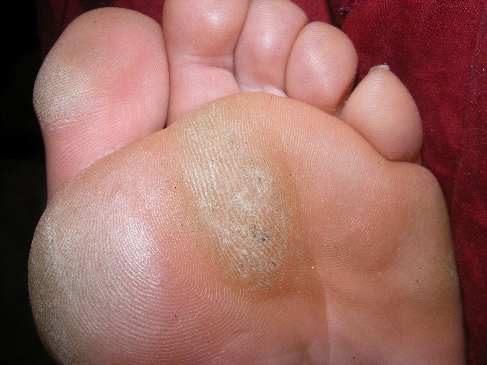 Remember to Take Care of Your Feet + Giveaway