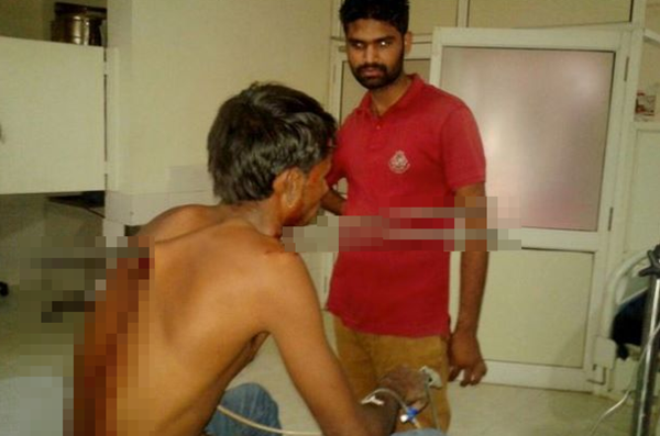 (GAMBAR) NGERI! Masih Hidup Walau Cedera Parah (GAMBAR) NGERI! Masih Hidup Walau Cedera Parah