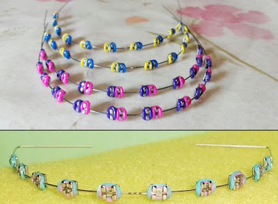 Cara pemasangan behel fashion sendiri dan behel lepas pasang Cara pemasangan behel fashion sendiri dan behel lepas pasang