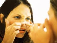 Cara menghilangkan jerawat alami di wajah