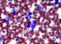 MYELOMONOCYTIC MYELOMONOCYTIC