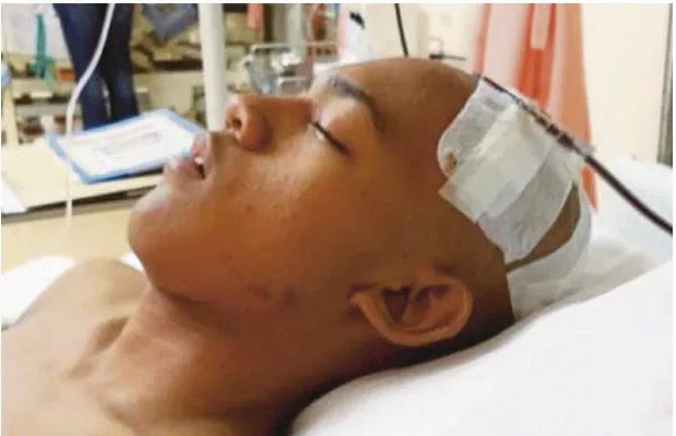 15+ Arti Mimpi Kepala Terkena Bola