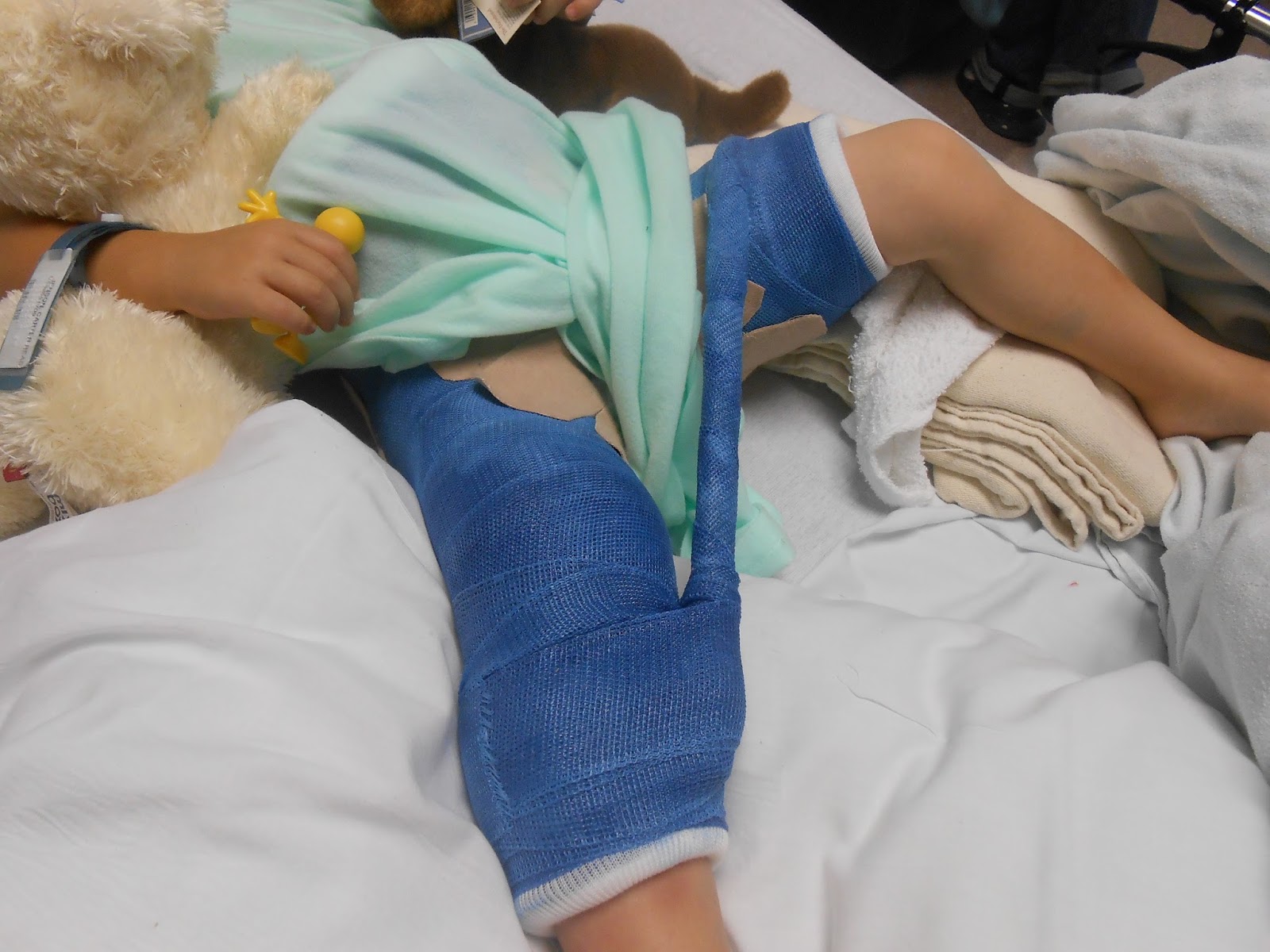 THOMAS AND JENNIFER Carter's Broken Leg