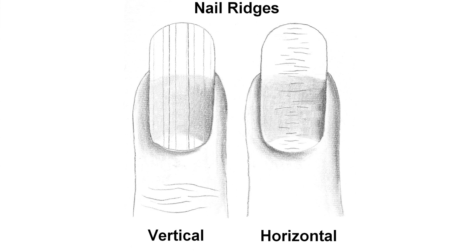 Bella10 Nails November 2017 Why Do I Have Nail Ridges