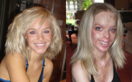 katie+before_and_after.jpg
