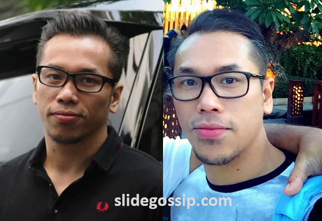 sammy-simorangkir-suntik-putih-tanam-benang-operasi-plastik-benarkah.jpg