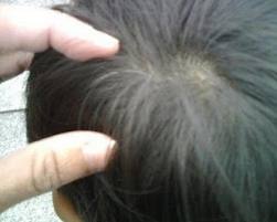 penyebab uban penyebab timbulnya uban