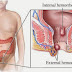 OBAT WASIR HERBAL thumbnail