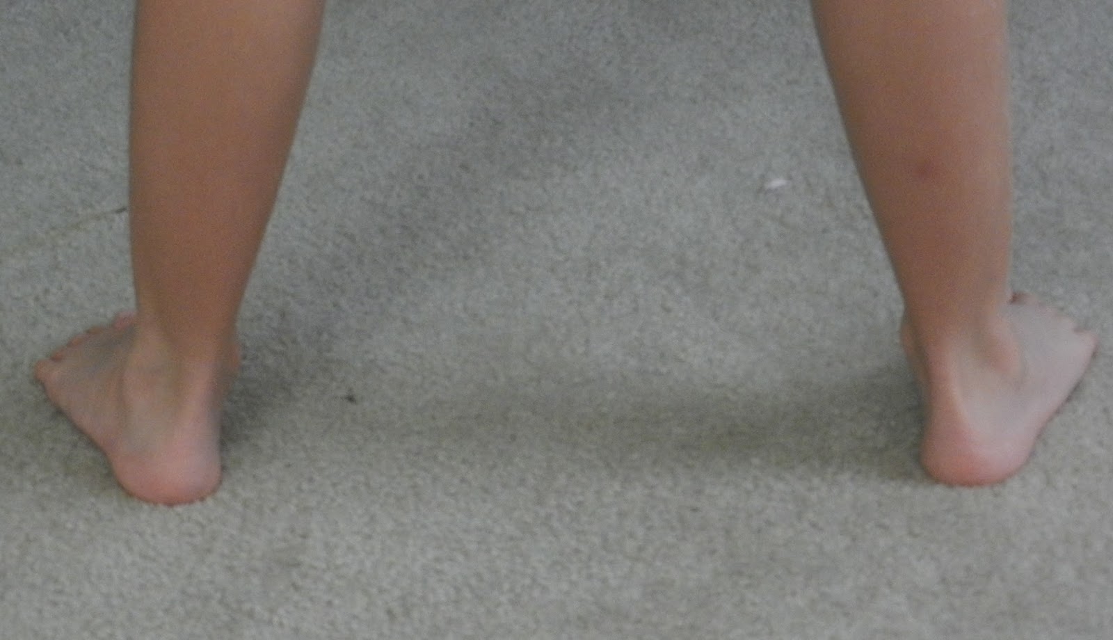 THIS I KNOW a mommy blog about our son with special needs