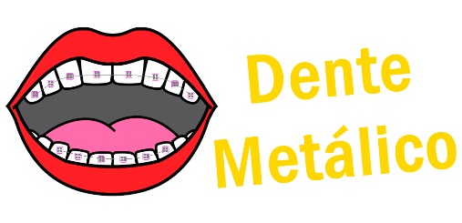 Dente Metálico