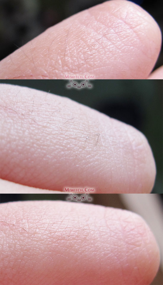 Review no! no! Hair Professional Hair Removal Device