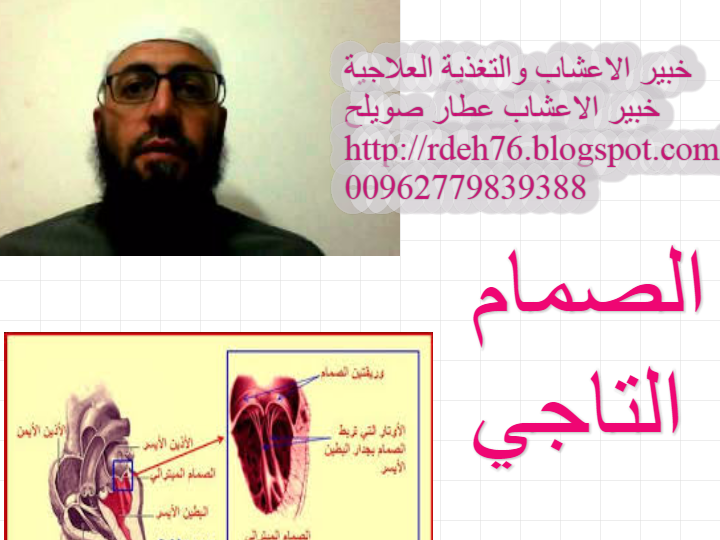 انس د ال الصمام التاجي امراض القلب والاعشاب