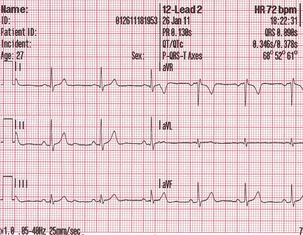 Heart Rhythm 2011 Program