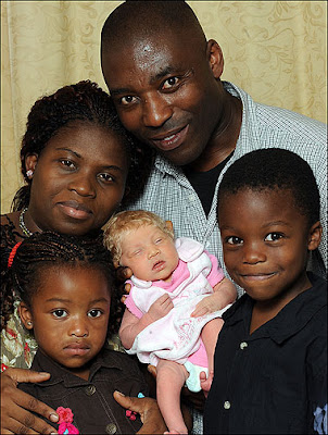 Black parents give birth to a white baby