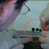 Miracle molecule that can help fight cancer, can be found in Tick's saliva.