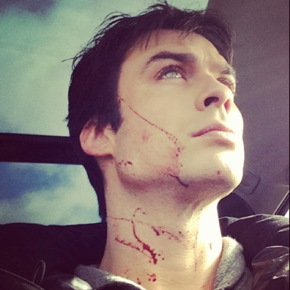 FOTO : The Vampire Diaries " Ian Somerhalder assusta fãs com ' rosto  ensanguentado ' Leia mais e