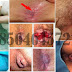 Tanaman Obat Untuk Mengobati Ambeien Wasir (Hemoroid) thumbnail