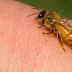 Nicin, Hilangkan Rasa Sakit Sengatan Lebah