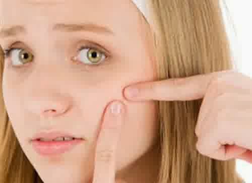 Strawberry Mask to Overcome Acne