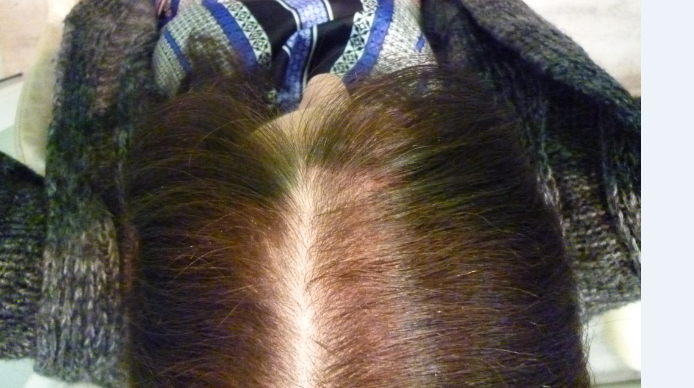 Mixit la máscara para el crecimiento de los cabello