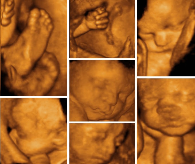 Life Through the Lens 4D Baby Scan Pregnancy Scanning 4D Baby Scan