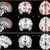 Brain imaging shows enhanced executive brain function in people with musical training