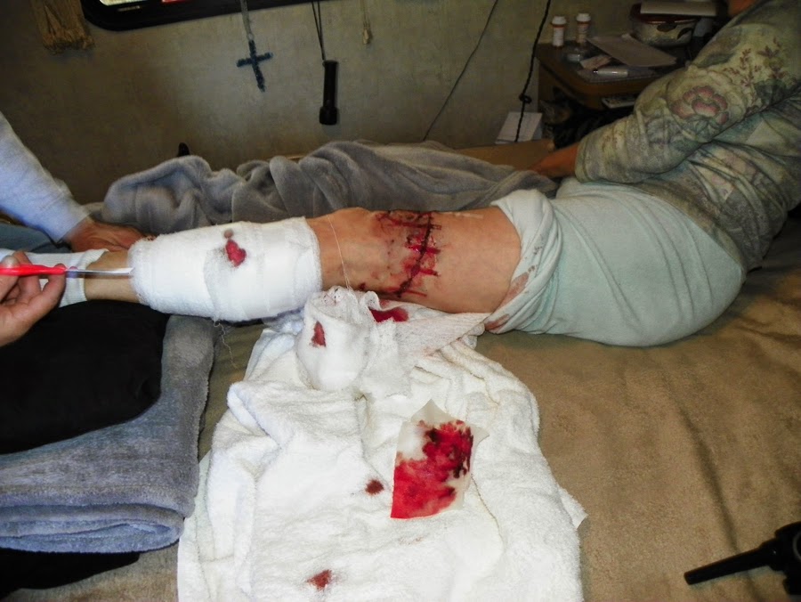 attacks by breed 17 barks attack report by breed aug 2014 attacks by breed 17 barks attack report by breed aug 2014