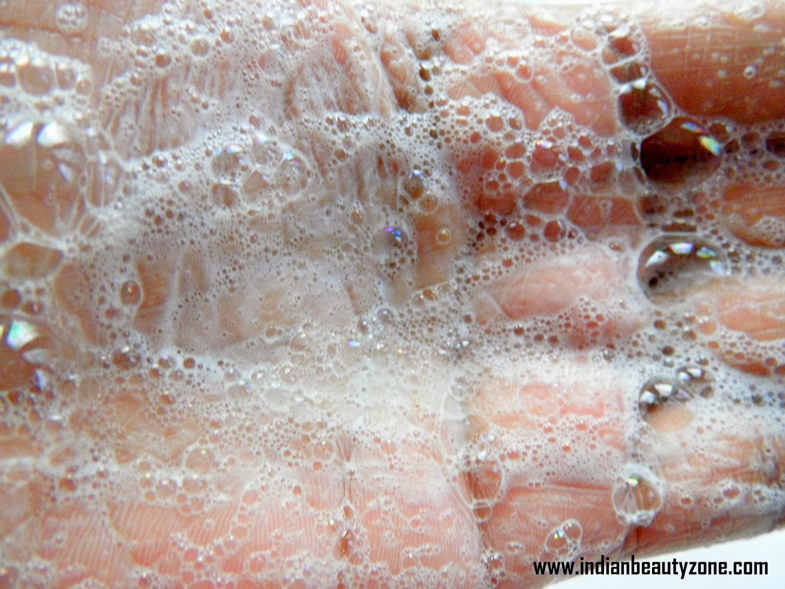 Five Things Women Can Do To Prevent Acne Breakouts How to cure acne in home
