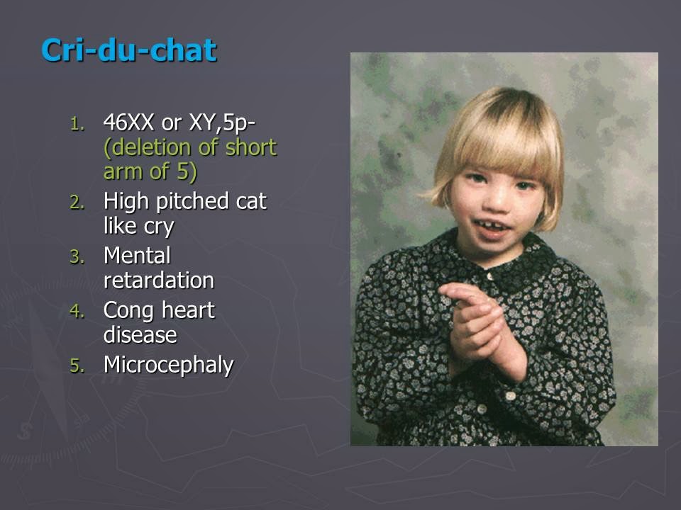 Slide 44
