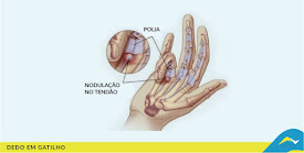 Tratamento de dores e doenças articulares