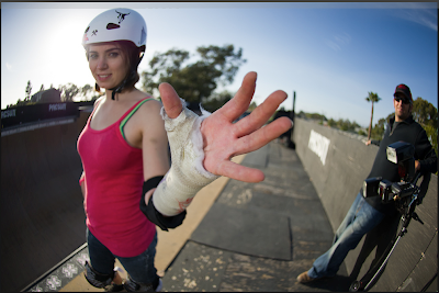 http://4.bp.blogspot.com/-fracq-iIf_Y/Tyw7SRr-OyI/AAAAAAAACs8/OQuu1NvRPew/s320/amelia_brodka_wrist.png