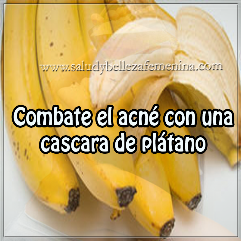 Combate el acné con una cascara de plátano Cuidados de la piel , remedios caseros , tratamientos de la piel , plátano , acné
