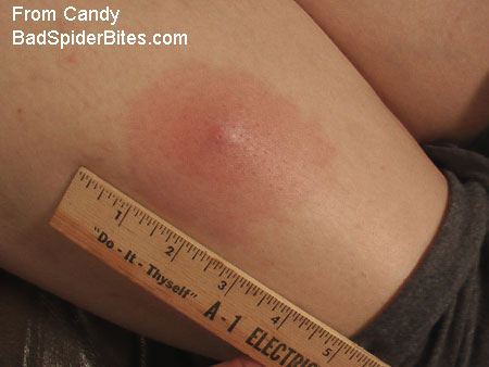 Colten's Blog: December 2011