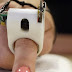 To MIT κατασκευάζει συσκευή - δαχτυλίδι για τυφλούς