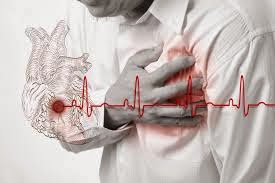 Πώς να επιβιώσετε από καρδιακή προσβολή όταν είστε μόνοι..; Κοινοποιήστε το παντού θα σώσετε ζωές!!