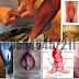 Obat Wasir Venaron Resep Dokter Hospital thumbnail