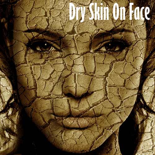 Dry Skin On Face