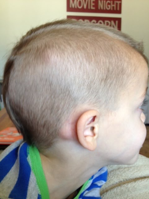 bump behind ear
