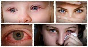 Las ojeras oscuras del problema con los riñones