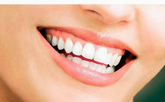 CARA ALAMI MEMUTIHKAN GIGI Tips Gigi Sehat dan Bersih