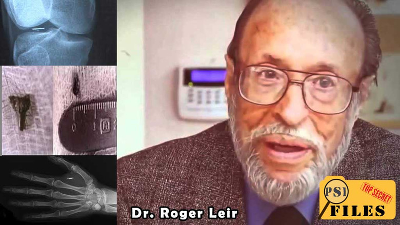 Ο Δρ Roger Lear και η μελέτη του για περιπτώσεις εμφύτευσης εξωγήινων εμφυτευμάτων στους ανθρώπους Ο Δρ Roger Lear και η μελέτη του για περιπτώσεις εμφύτευσης εξωγήινων εμφυτευμάτων στους ανθρώπους