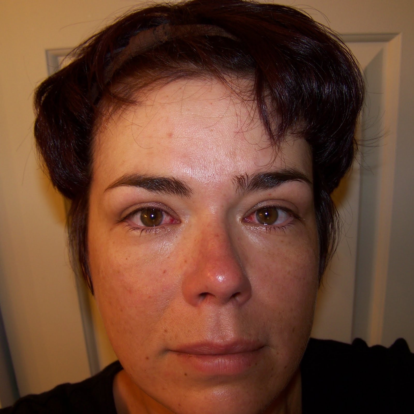 Sculpted Windows Jewelry Journal 2 Days After Eye Surgery....