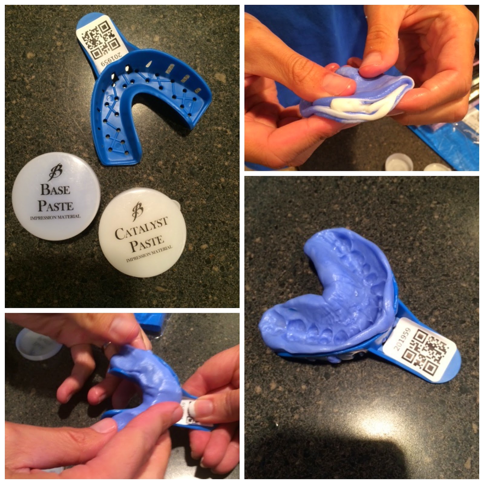 Smile Brilliant Teeth Whitening Kit Review & Giveaway