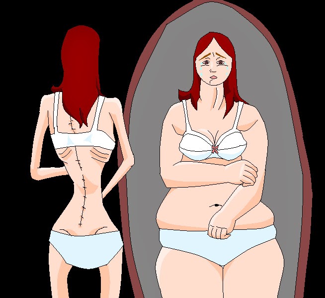 Raiz do problema na Anorexia